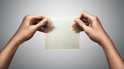 MOLNLYCKE Exufiber Ag 5x5cm Gelový obvaz s rychlým antibakteriálním účinkem, 10 ks