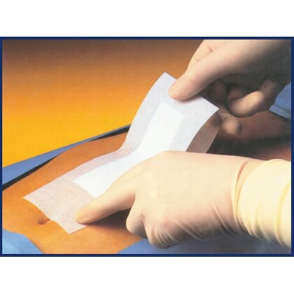 Pharmapore Samolepiaci sterilný obväz z netkanej textílie, 10x25cm, v balení 40ks