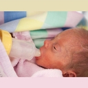 MEDELA SpecialNeeds kojenecká láhev pro děti s ráštepom rty, podnebí a jinými problémy